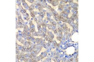 Immunohistochemistry of paraffin-embedded rat liver using FAH antibody at dilution of 1:100 (x40 lens).