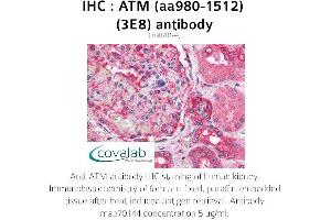 Image no. 1 for anti-Ataxia Telangiectasia Mutated (ATM) (AA 980-1512) antibody (ABIN1723092) (ATM Antikörper  (AA 980-1512))