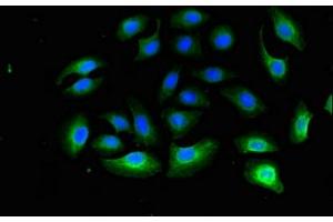 Immunofluorescent analysis of A549 cells using ABIN7142744 at dilution of 1:100 and Alexa Fluor 488-congugated AffiniPure Goat Anti-Rabbit IgG(H+L) (RPL13A Antikörper  (AA 63-190))