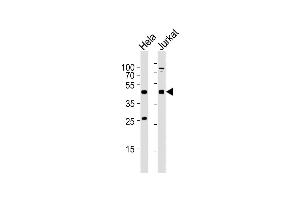 All lanes : Anti-AVPR2 Antibody (C-term) at 1:2000 dilution Lane 1: Hela whole cell lysates Lane 2: Jurkat whole cell lysates Lysates/proteins at 20 μg per lane. (AVPR2 Antikörper  (C-Term))