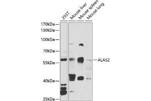 Western blot analysis of extracts of various cell lines, using  antibody (ABIN6129839, ABIN6136757, ABIN6136758 and ABIN6222179) at 1:1000 dilution. (ALAS2 Antikörper  (AA 50-320))