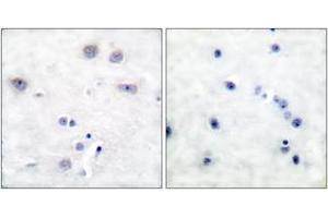 Immunohistochemistry analysis of paraffin-embedded human brain tissue, using Shc (Ab-427) Antibody. (SHC1 Antikörper  (AA 393-442))