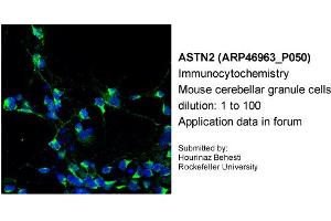 Immunocytochemistry --Sample Type: Mouse cerebellar granule cellsDilution: 1:100 (Astrotactin 2 Antikörper  (N-Term))