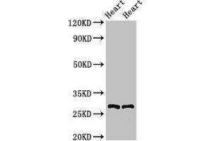 Western Blot Positive WB detected in: Rat heart tissue, Mouse heart tissue All lanes: MYF5 antibody at 2. (MYF5 Antikörper  (AA 1-255))