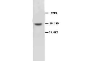 MMP16 Polyclonal Antibody (MMP16 Antikörper  (C-Term))