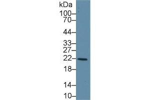 Western Blot; Sample: Human Liver lysate; Primary Ab: 1µg/ml Rabbit Anti-Human GSTk1 Antibody Second Ab: 0. (GSTK1 Antikörper  (AA 7-222))