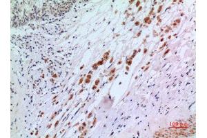 Immunohistochemistry (IHC) analysis of paraffin-embedded Human Brain, antibody was diluted at 1:100. (IFN-AlphaR2 (N-Term) Antikörper)