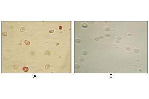Immunocytochemistry analysis of TPA induced BCBL-1 cells (A) and uninduced BCBL-1 cells (B) using KSHV ORF45 antibody with AEC staining. (KSHVORF45 Antikörper)