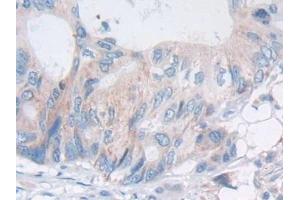Immunohistochemistry (IHC) image for anti-Acid Phosphatase, Prostate (ACPP) (AA 217-386) antibody (ABIN7431248)