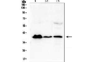 Western blot analysis of MR1 using anti-MR1 antibody (ABIN6719587).