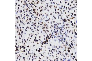 Immunohistochemistry of paraffin-embedded rat kidney tissue, using HMGB1 antibody.