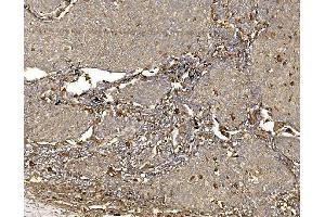 IHC analysis of WFS1 using anti-WFS1 antibody (ABIN7602165). (WFS1 Antikörper  (AA 61-313))