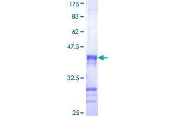 CENPJ Protein (AA 979-1088) (GST tag)