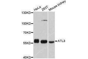Western blot analysis of extracts of various cell lines, using ATL3 antibody. (ATL3 Antikörper  (AA 360-440))