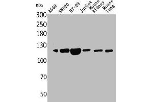 Western Blot analysis of A549 SW620 HT29 Jurkat mouse kidney mouse lung cells using CD133 Polyclonal Antibody (CD133 Antikörper  (N-Term))