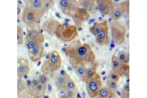 Used in DAB staining on fromalin fixed paraffin-embedded Liver tissue (CSNK1A1 Antikörper  (AA 114-324))