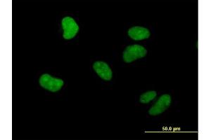 Immunofluorescence of purified MaxPab antibody to WHSC1 on HeLa cell.
