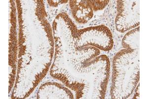 IHC-P Image Immunohistochemical analysis of paraffin-embedded human gastric tissue, using Centaurin alpha 1, antibody at 1:100 dilution.