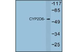 Image no. 1 for anti-Cytochrome P450, Family 2, Subfamily D, Polypeptide 6 (CYP2D6) antibody (ABIN317680) (CYP2D6 Antikörper)