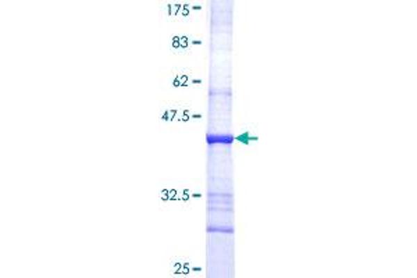 CYP51A1 Protein (AA 410-509) (GST tag)