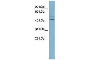 SLC46A1 antibody used at 1 ug/ml to detect target protein.