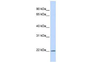 IFN Alpha 5 antibody used at 1 ug/ml to detect target protein. (IFNA5 Antikörper  (Middle Region))
