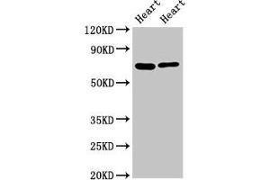 Western Blot Positive WB detected in: Rat heart tisseu, Mouse heart tissue All lanes: FASTKD2 antibody at 8 μg/mL Secondary Goat polyclonal to rabbit IgG at 1/50000 dilution Predicted band size: 82, 75 kDa Observed band size: 75 kDa (FASTKD2 Antikörper  (AA 117-203))