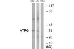 Image no. 1 for anti-ATP Synthase, H+ Transporting, Mitochondrial F1 Complex, gamma Polypeptide 1 (ATP5C1) (AA 131-180) antibody (ABIN2890140) (ATP5C1 Antikörper  (AA 131-180))
