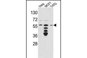 Western blot analysis of FKBP4 Antibody (Center) (ABIN391579 and ABIN2841513) in Hela,MCF7,T47D cell line lysates(35 μg/lane). (FKBP4 Antikörper  (AA 186-216))