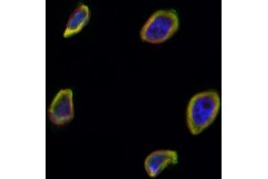 ABIN6265731 and ABIN6266699 staining Hela by IF/ICC. (TRIM24 Antikörper  (C-Term))