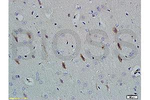 Formalin-fixed and paraffin embedded rat brain tissue labeled with Rabbit Anti-Neuroligin 1 Polyclonal Antibody (ABIN705311) at 1:200 followed by conjugation to the secondary antibody and DAB staining. (Neuroligin 1 Antikörper  (AA 701-800))