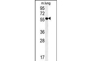ZMYND10 Antibody (C-term) (ABIN652018 and ABIN2840499) western blot analysis in mouse lung tissue lysates (15 μg/lane). (ZMYND10 Antikörper  (C-Term))