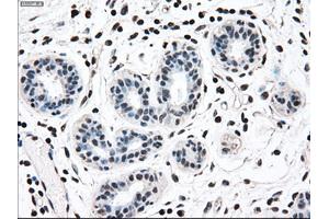 Immunohistochemical staining of paraffin-embedded breast tissue using anti-MAP2K2 mouse monoclonal antibody. (MEK2 Antikörper)