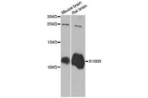 Western blot analysis of extracts of various cell lines, using S100B antibody. (S100B Antikörper  (AA 1-92))