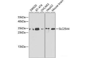 Western blot analysis of extracts of various cell lines using SLC25A4 Polyclonal Antibody.