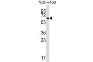Western Blotting (WB) image for anti-Zinc Finger Protein 340 (ZNF340) antibody (ABIN2998810) (ZBTB46 Antikörper)