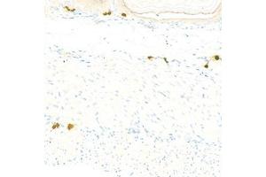 Immunohistochemistry analysis of paraffin-embedded mousestomachusing Chymase (ABIN7073506) at dilution of 1:1000 (CMA1 Antikörper)
