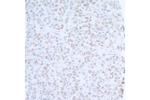 Immunohistochemistry (IHC) image for anti-Ubiquitin Protein Ligase E3 Component N-Recognin 5 (UBR5) (AA 600-650) antibody (ABIN7454646) (UBR5 Antikörper  (AA 600-650))
