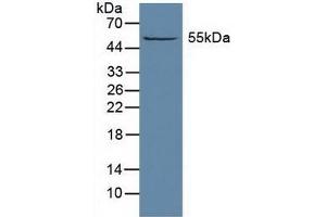 Detection of ALDH1A1 in Rat Liver Tissue using Polyclonal Antibody to Aldehyde Dehydrogenase 1 Family, Member A1 (ALDH1A1) (ALDH1A1 Antikörper  (AA 2-501))