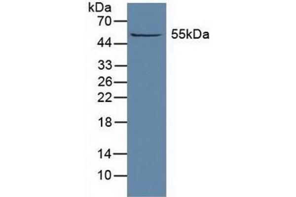ALDH1A1 Antikörper  (AA 2-501)