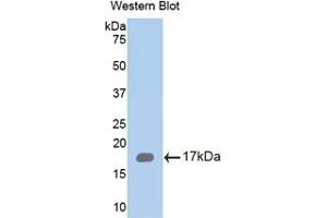 Western blot analysis of the recombinant protein. (Chemerin Antikörper  (AA 33-158))