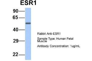 Host:  Rabbit  Target Name:  ESR1  Sample Type:  Human Fetal Muscle  Antibody Dilution:  1. (Estrogen Receptor alpha Antikörper  (Middle Region))