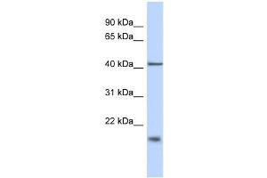 WB Suggested Anti-TBC1D21 Antibody Titration: 0. (TBC1D21 Antikörper  (N-Term))