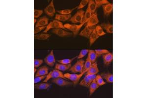 Immunofluorescence (IF) image for anti-Suppressor of Cytokine Signaling 2 (SOCS2) antibody (ABIN7270641)