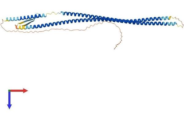 KRT17 Protein (AA 1-432) (His tag)