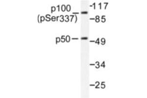 Image no. 1 for anti-Nuclear Factor of kappa Light Polypeptide Gene Enhancer in B-Cells 1 (NFKB1) (pSer337) antibody (ABIN318079) (NFKB1 Antikörper  (pSer337))