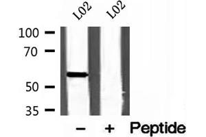 Western blot analysis of extracts of L02 cells, using CYP26B1 antibody. (CYP26B1 Antikörper  (Internal Region))