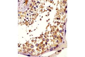 (ABIN6243764 and ABIN6578200) staining KISS1 in human testis tissue sections by Immunohistochemistry (IHC-P - paraformaldehyde-fixed, paraffin-embedded sections). (KISS1 Antikörper  (AA 20-52))