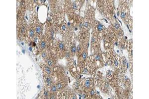 ABIN6266653 at 1/100 staining human liver tissue sections by IHC-P.