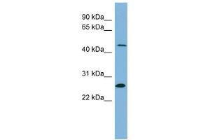UPB1 antibody used at 1 ug/ml to detect target protein. (UPB1 Antikörper  (Middle Region))